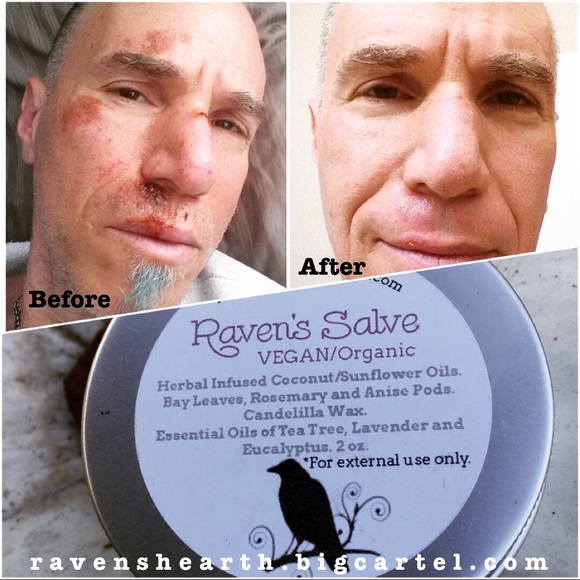🌿Raven's Salve🌿 Multi-use healing balm - Picture 3 of 8